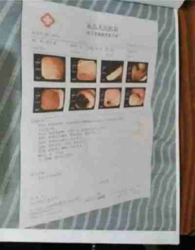 国医楷模陈海林 | 癌细胞逆转正常生理细胞 引起全球广泛关注 —— 五一特别报道